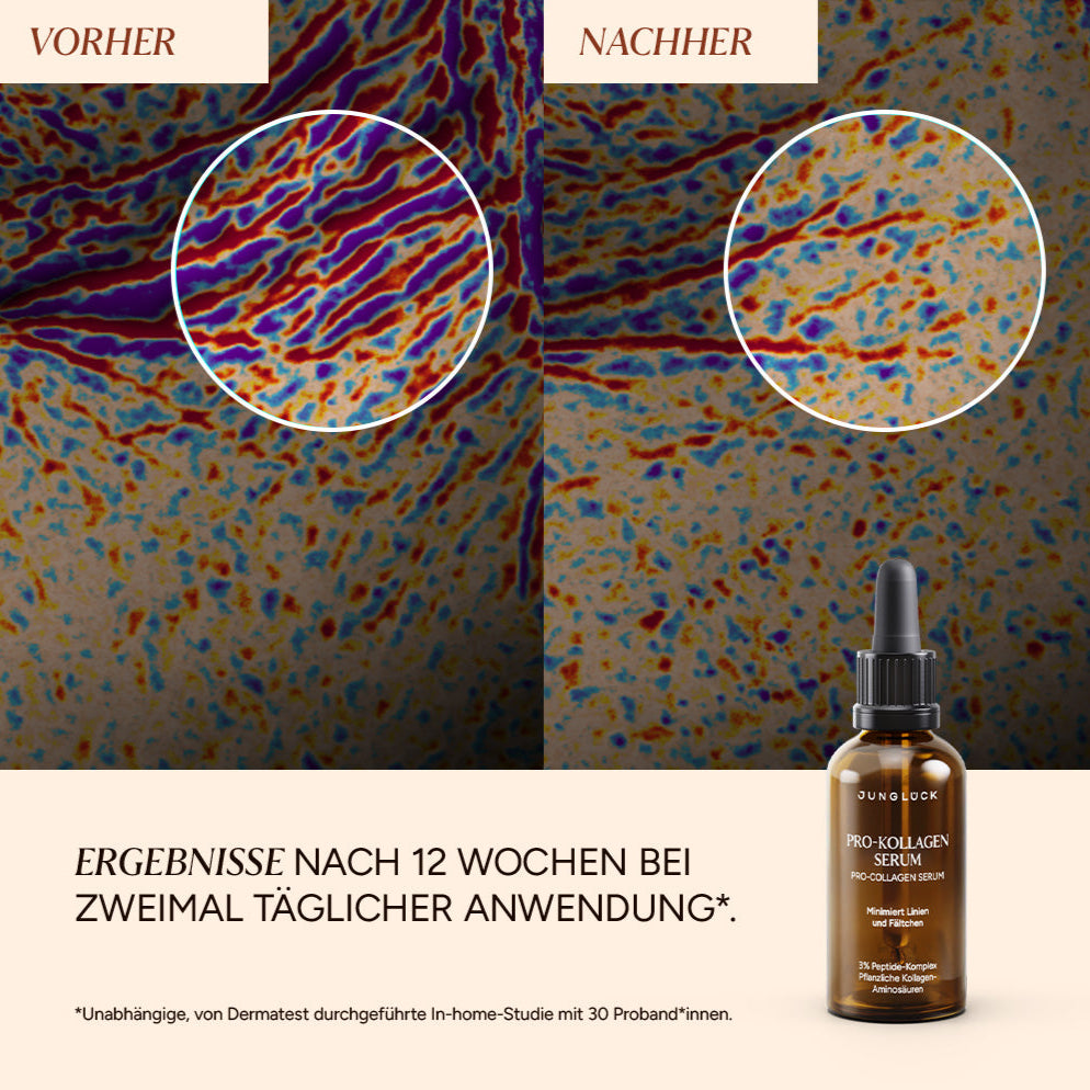 Pro-Kollagen-Serum_Produktbilder_1000x1000px_VorherNachher.jpg